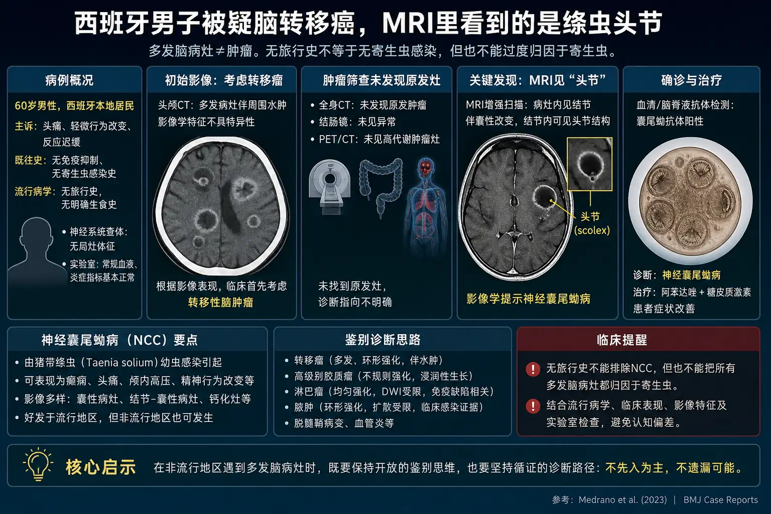 西班牙男子被疑脑转移癌,MRI里看到的是绦虫头节